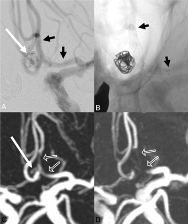 Fig 2.