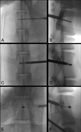 Fig 1.
