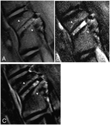 Fig 4.
