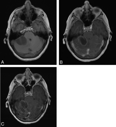 Fig 1.