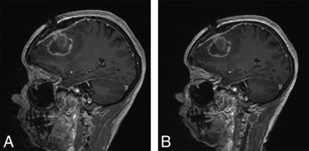 Fig 2.