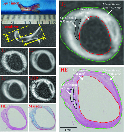 Fig 2.