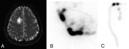 Fig 3.
