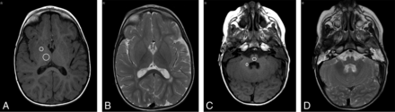 Fig 1.