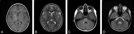 Fig 2.