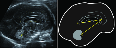 Fig 1.