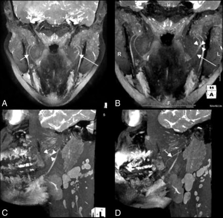 Fig 2.