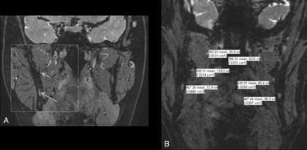Fig 3.