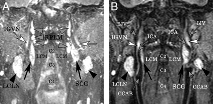 Fig 2.