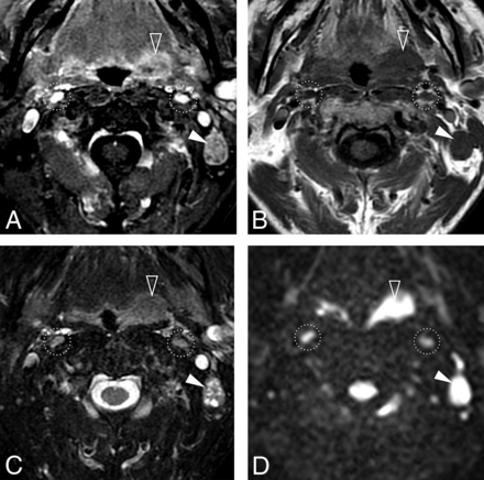 Fig 3.