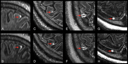 Fig 3.