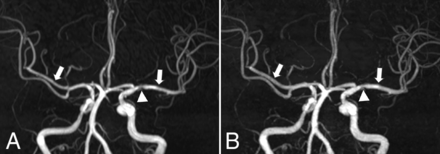 Fig 2.