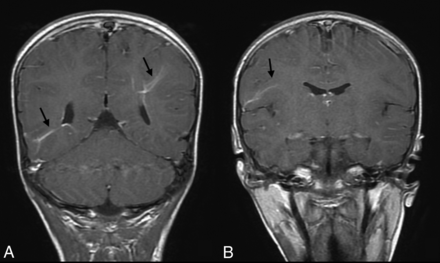 Fig 1.