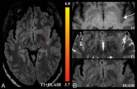 Fig 3.