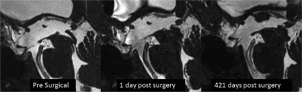 Fig 3.