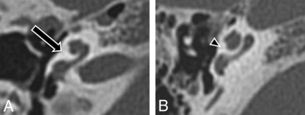 Fig 1.