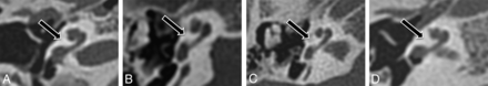 Fig 2.