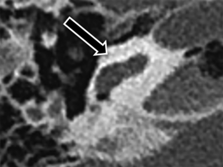Fig 3.