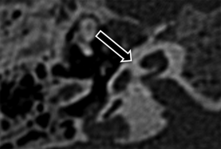 Fig 4.