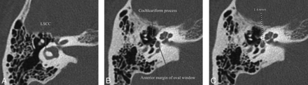 Fig 3.