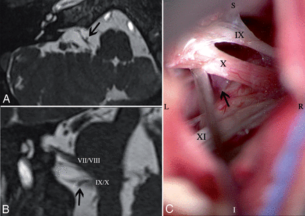 Fig 3.