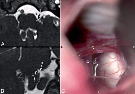 Fig 4.