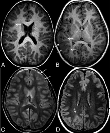 Fig 1.