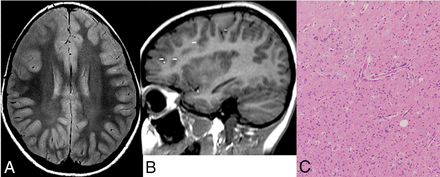 Fig 2.