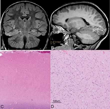 Fig 3.