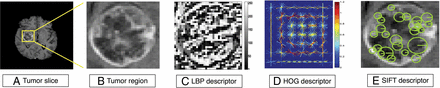Fig 1.