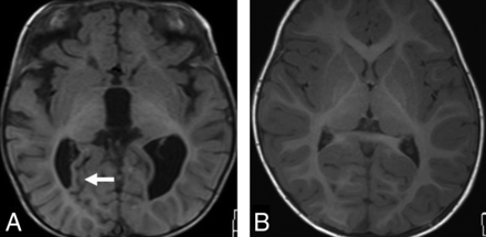 Fig 5.