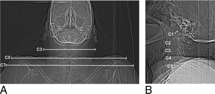 Fig 1.