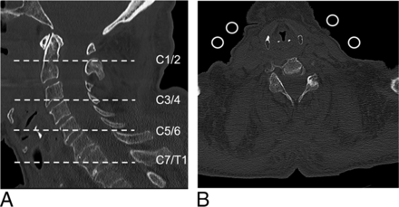 Fig 2.