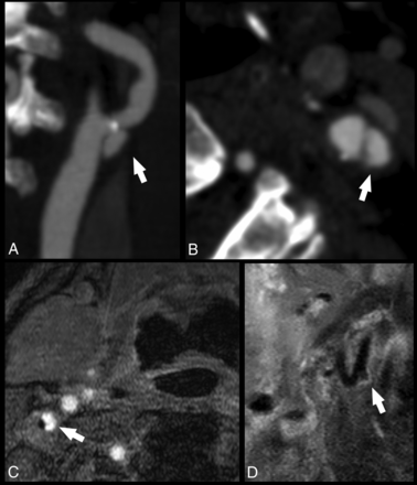 Fig 2.