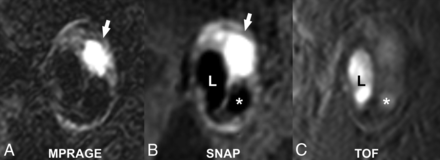 Fig 6.