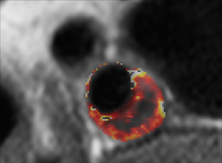 Fig 9.