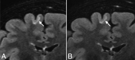 Fig 1.