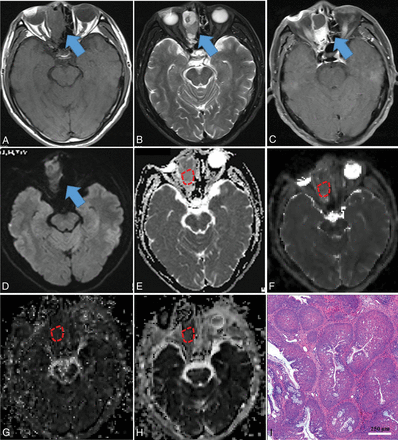 Fig 3.