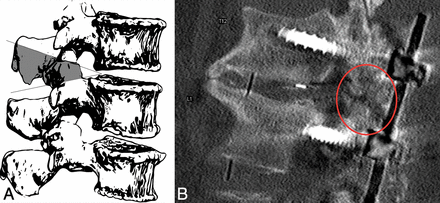 Fig 2.