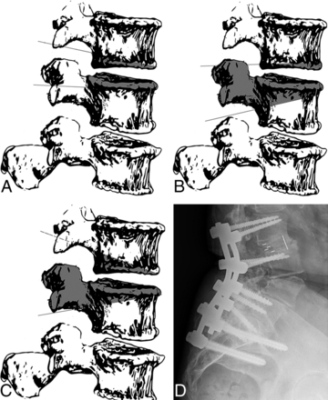 Fig 4.