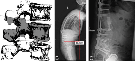 Fig 6.