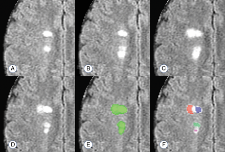 Fig 2.