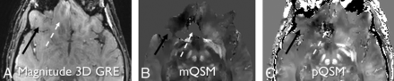 Fig 3.