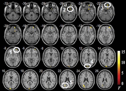 Fig 1.