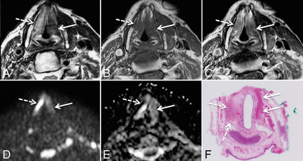 Fig 2.