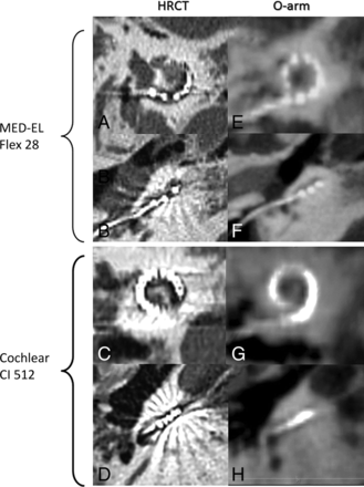 Fig 2.