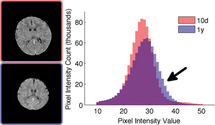 Fig 3.