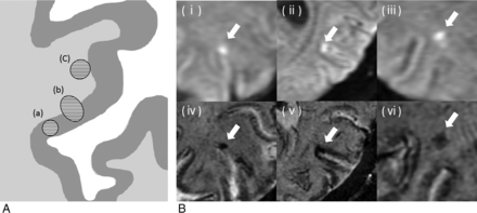 Fig 1.