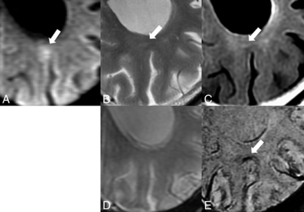 Fig 3.