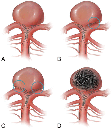 Fig 2.